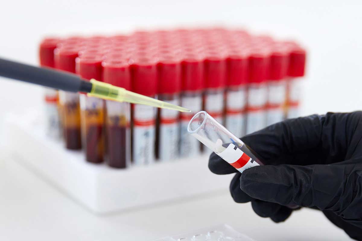 COMPREHENSIVE BLOOD TEST – Vita Medical Care